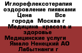 Иглорефлексотерапия, оздоровление пиявками › Цена ­ 3 000 - Все города, Москва г. Медицина, красота и здоровье » Медицинские услуги   . Ямало-Ненецкий АО,Лабытнанги г.